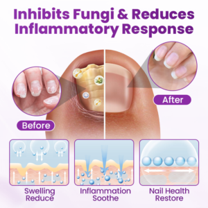 Foot Defense Mist - Image 8