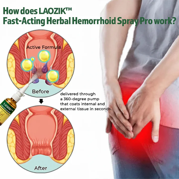 Fast-Acting Herbal Hemorrhoid Spray Pro - Image 6