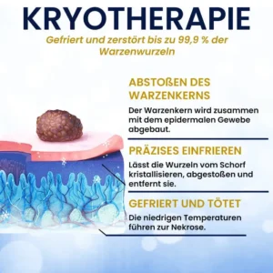 Kryo-Behandlungsspray - Image 6