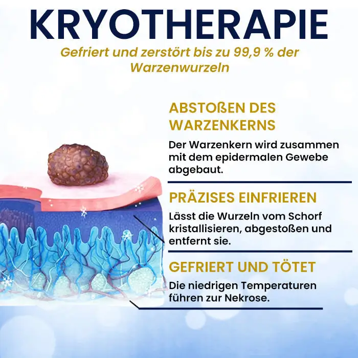 Kryo-Behandlungsspray - Image 6