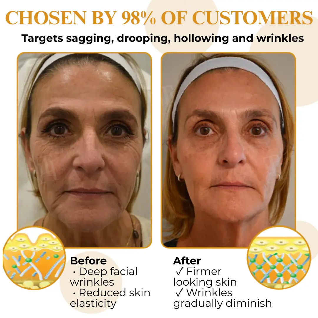 Letybo Bee Venom Wrinkle Removal Cream - Image 4