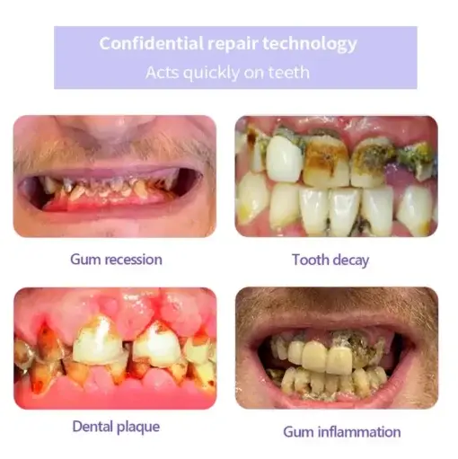 Teeth Restoration Mineral Powder - Image 4