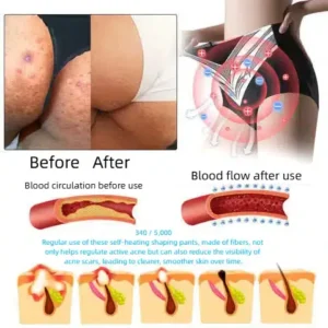 Self-regulating tourmaline shaping shorts with titanium fiber - Image 9