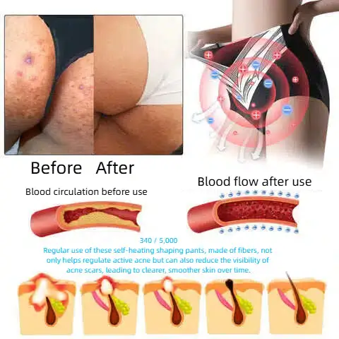 Self-regulating tourmaline shaping shorts with titanium fiber - Image 9