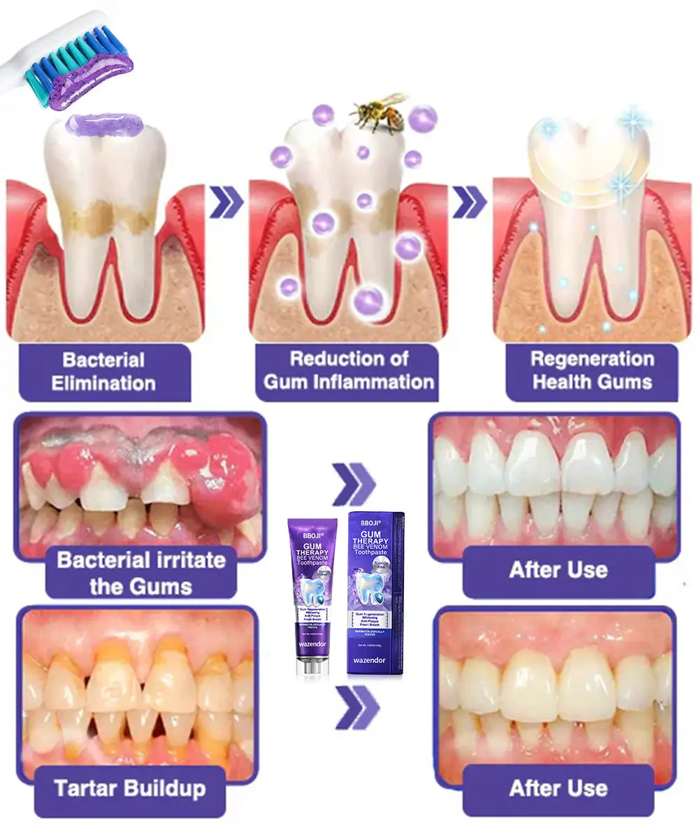 Bee Venom Dental Treatment Toothpaste - Image 7