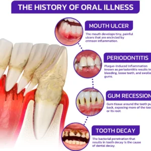 Bee Venom Dental Treatment Toothpaste - Image 9