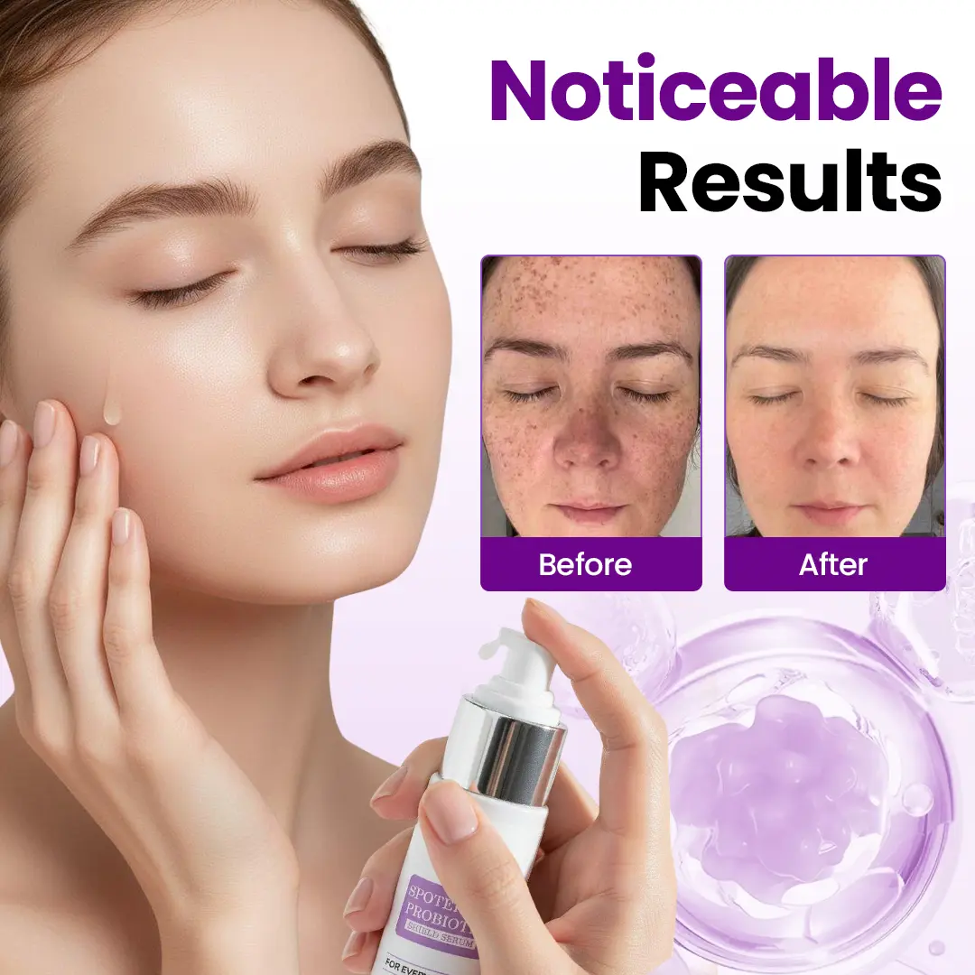Probiotic Shield Serum - Image 6