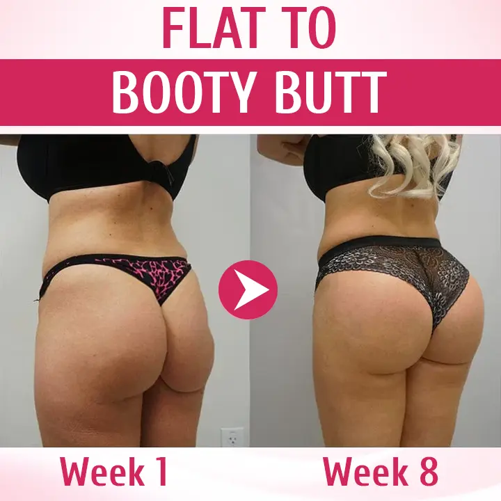 Breast & Hip Enhancement Cream - Image 8