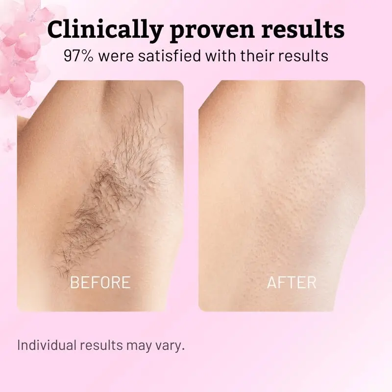 Beauty Rotundus Oil for Natural Permanent Hair Reduction - Image 3
