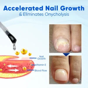 NailRebuild Nail Growth and Repair Serum+ - Image 5