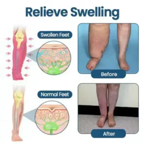 Roll-On Pump Cream for Lymphatic Drainage & Swelling Relief - Image 5