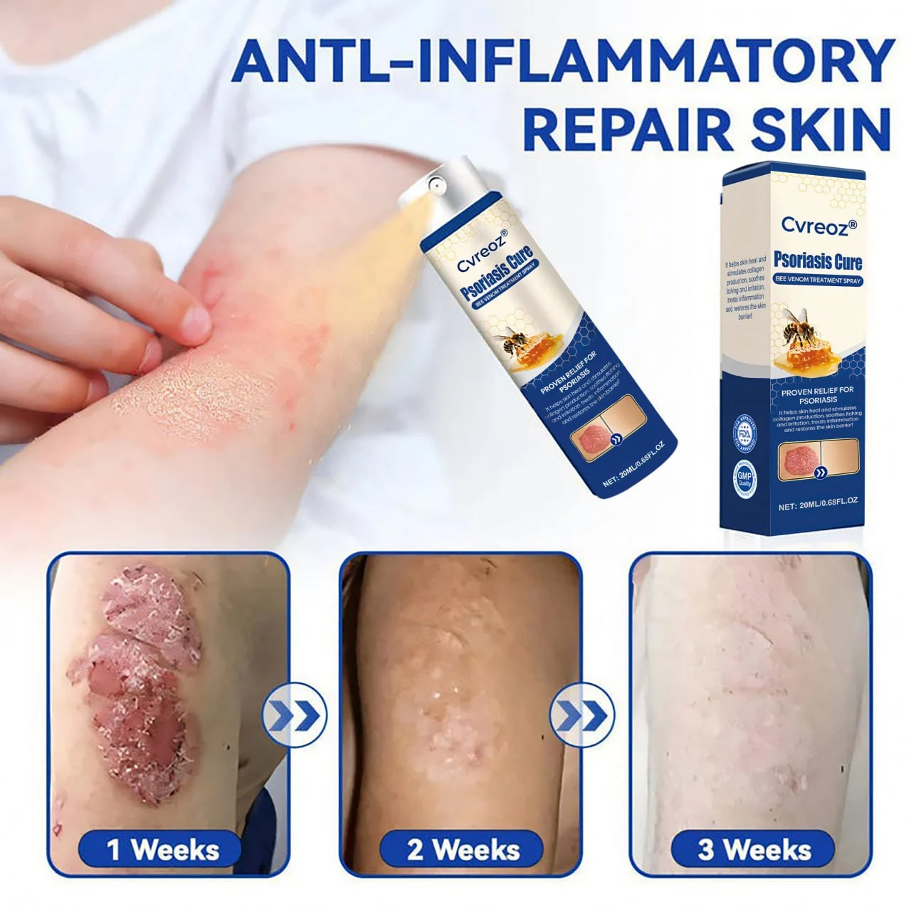 Psoriasis Cure Bee Venom Treatment Spray - Image 5