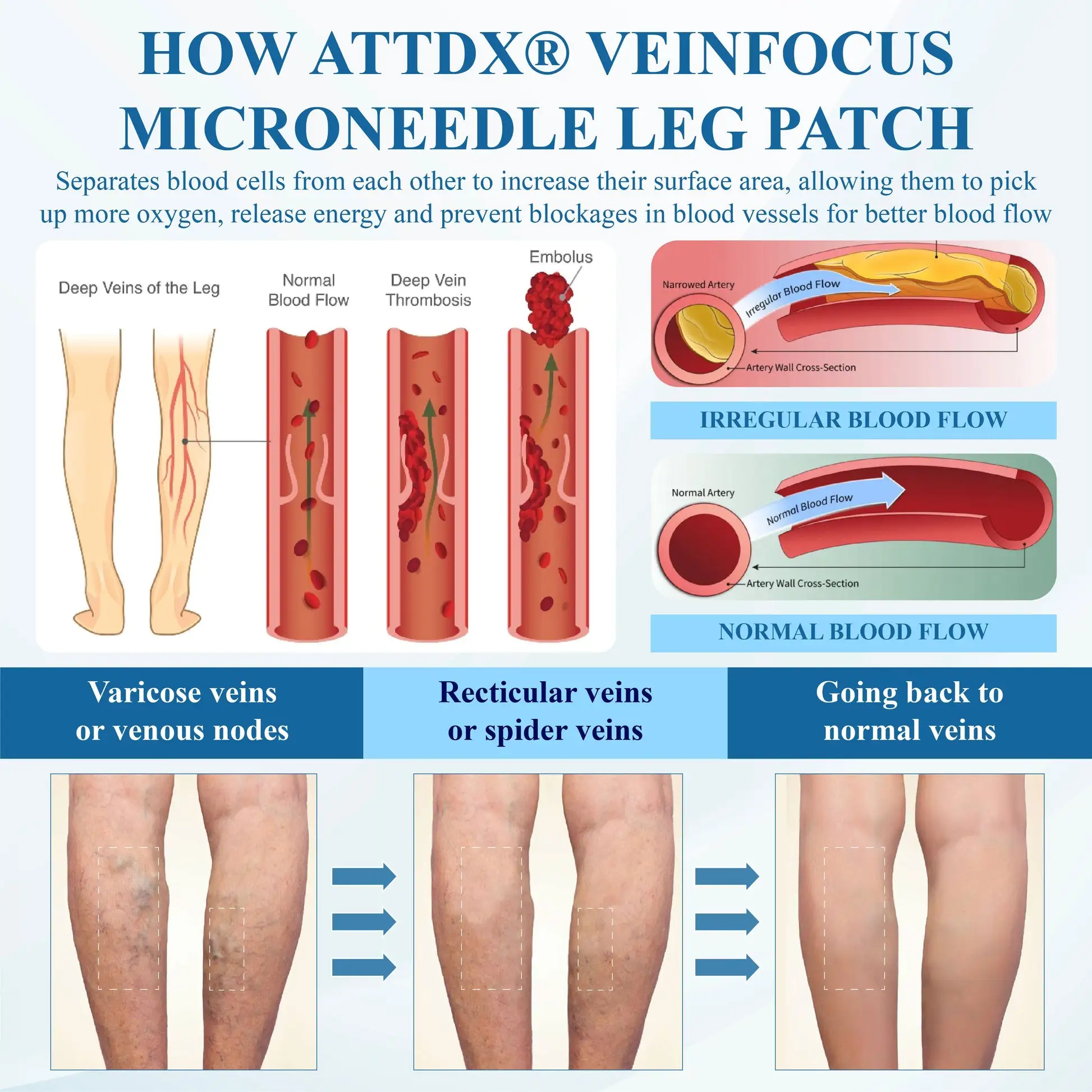 Microneedle Leg Patch - Image 11