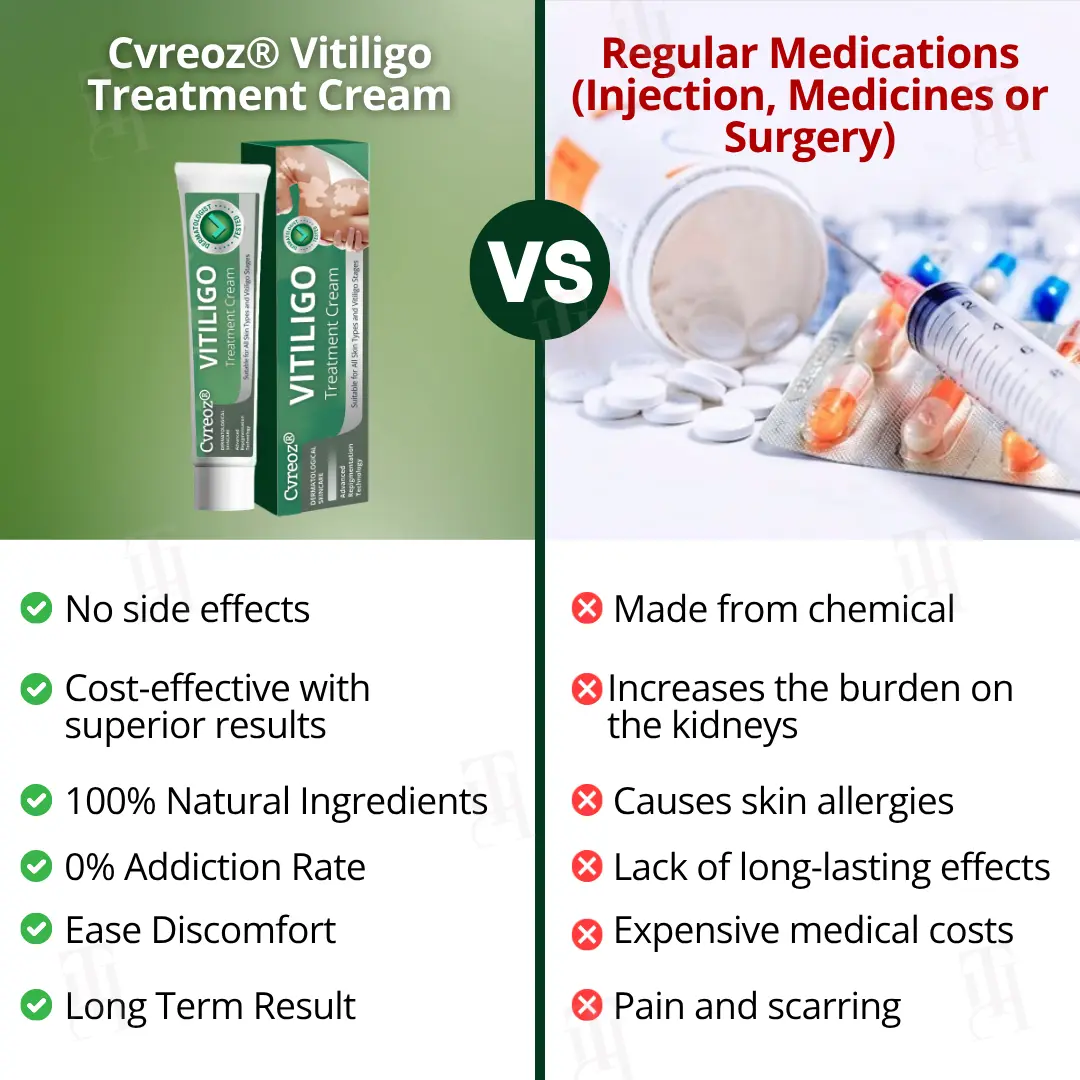 Vitiligo Treatment Cream - Image 4