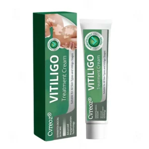 Vitiligo Treatment Cream