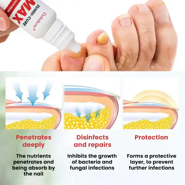 Fungi-Cure Max - Image 5