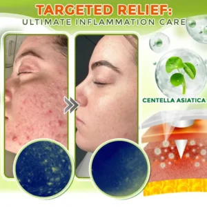 Comprehensive Microneedle Patch - Image 3