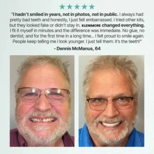 Full Denture with Strong Suction - Image 5