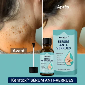 Sérum Anti-Verrues