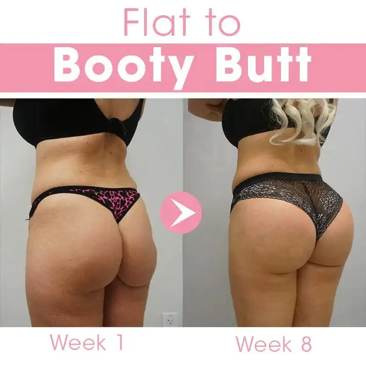BREAST HIP ENHANCEMENT CREAM - Image 6