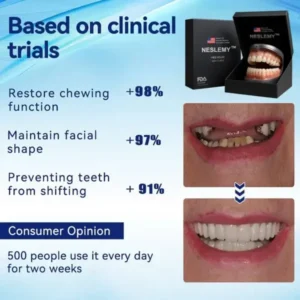 Advanced Customized Full Denture Set - Image 5