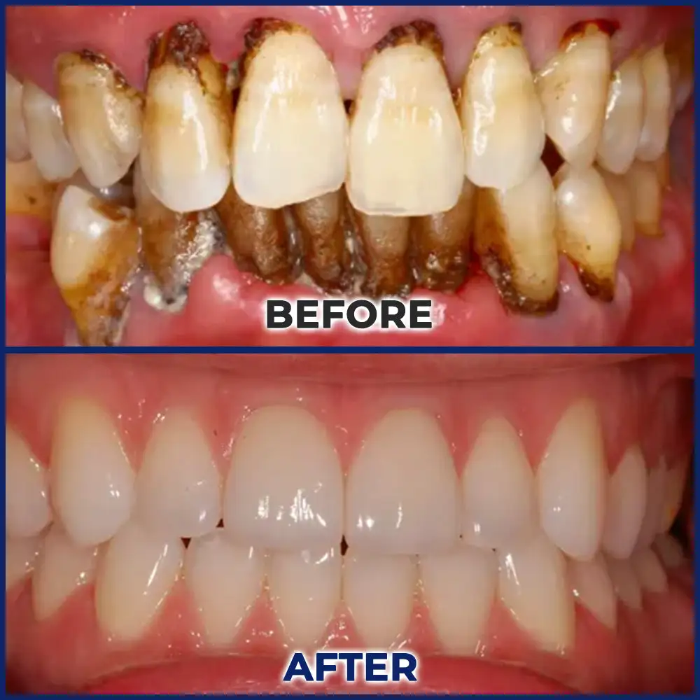Bee Venom Dental Treatment Drops Mouthwash - Image 6