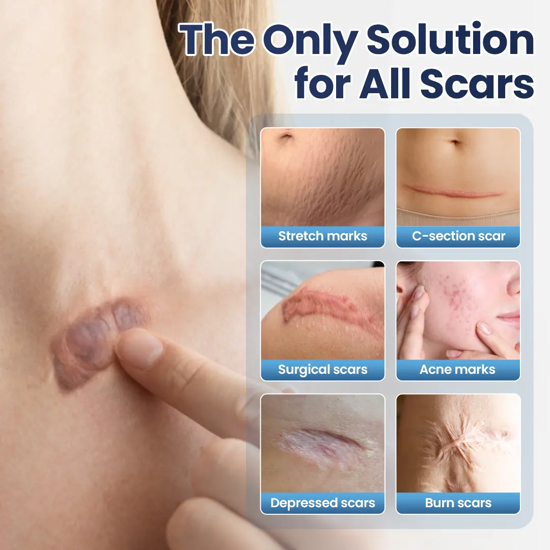 Texture Repair Gel - Image 7