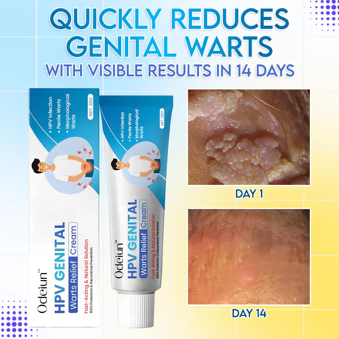 HPV Genital Warts Relief Cream - Image 2
