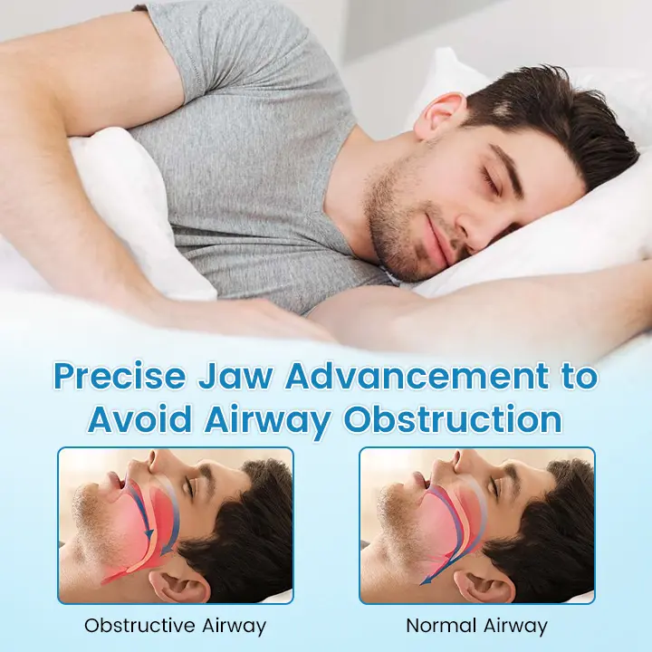 Sleep & Relax Breathing Protector – Dentist-Designed - Image 6