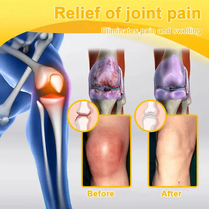 Botulinum Toxin & Bee Venom Pain-Relief Bone Healing Cream - Image 10