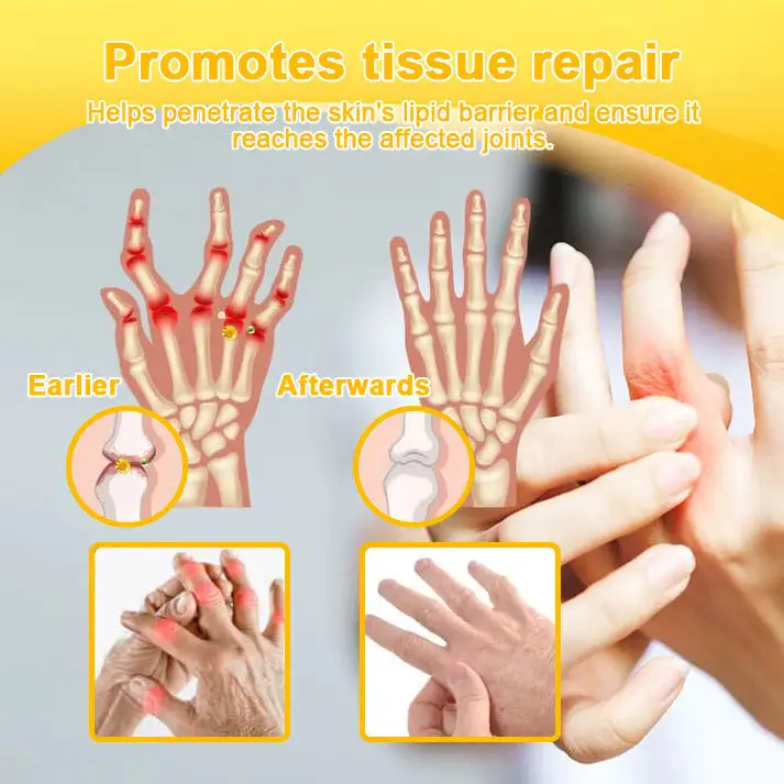 Botulinum Toxin & Bee Venom Pain-Relief Bone Healing Cream - Image 9