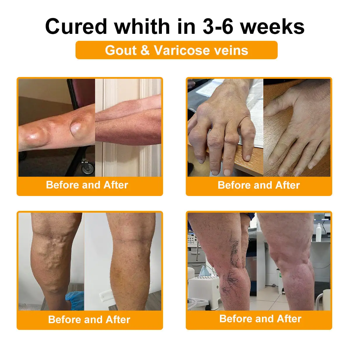 Botulinum Toxin & Bee Venom Pain-Relief Bone Healing Cream - Image 2
