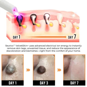 VelvetSkin+ All-in-One Laser Eraser Pen - Image 7