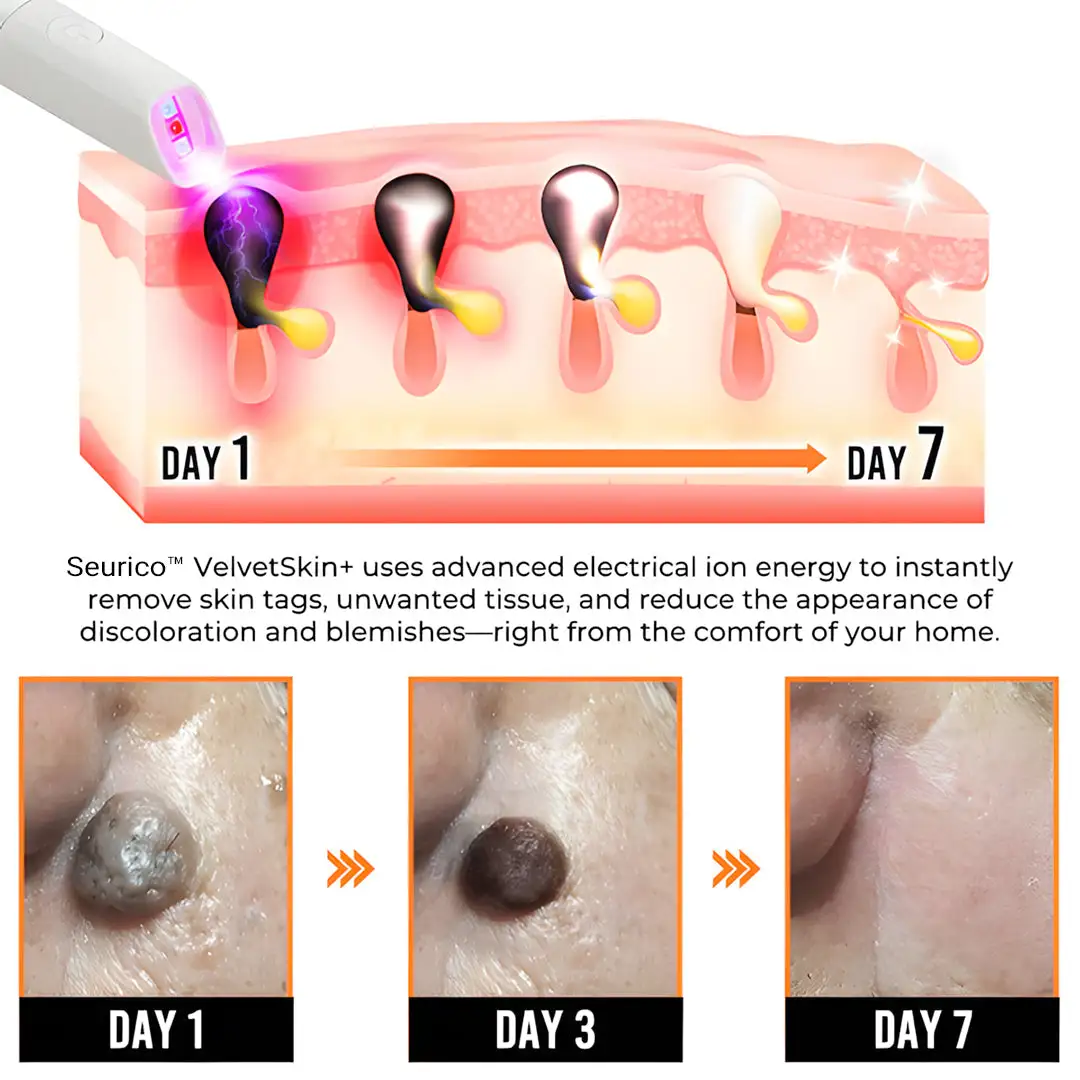 VelvetSkin+ All-in-One Laser Eraser Pen - Image 7