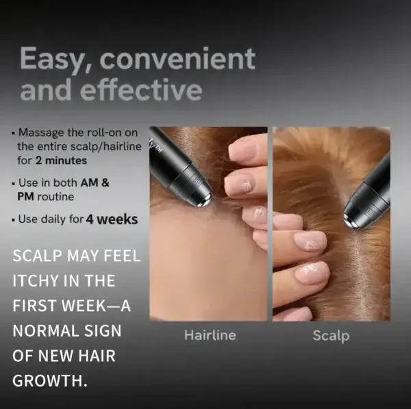 Professional Anti-Hair Loss Roll-On – Stimulates Hair Growth in 1–2 Weeks - Image 3