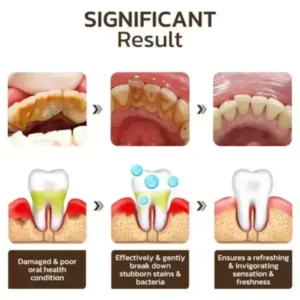 Niacinamide Whitening Toothpaste - Image 15