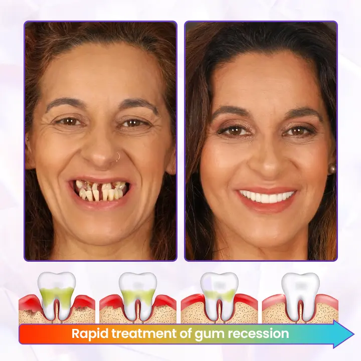 Advanced Gum Regeneration Toothpaste - Image 3