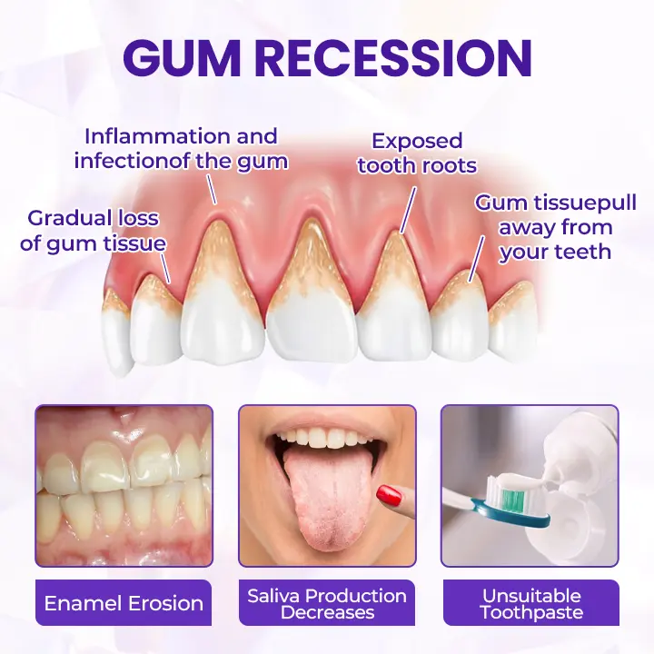 Advanced Gum Regeneration Toothpaste - Image 7