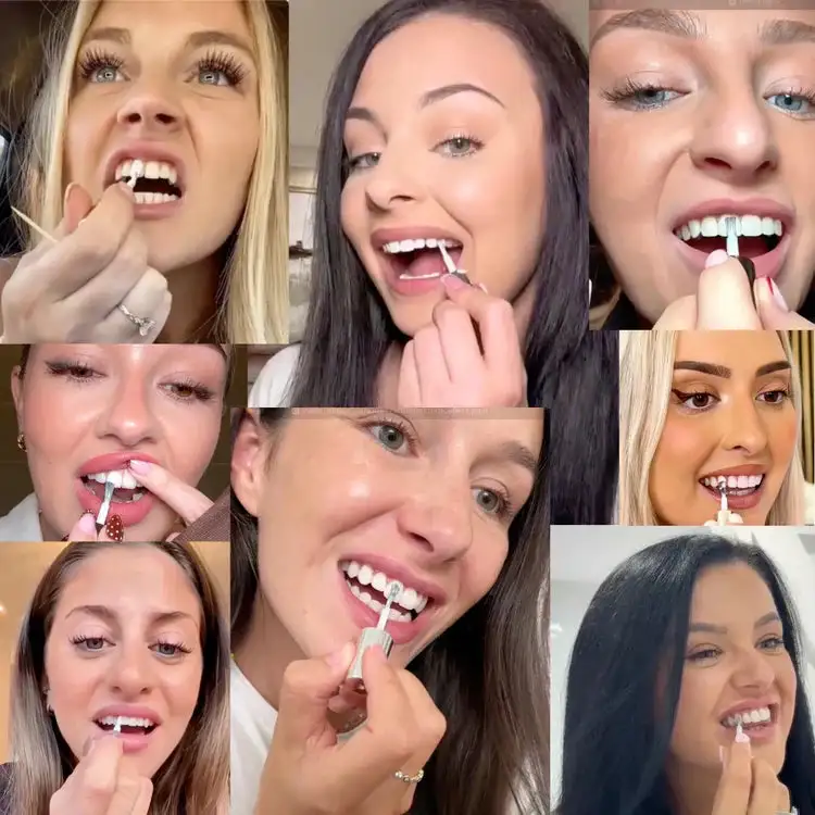 Instantly Whiter Smile🦷 - Image 3