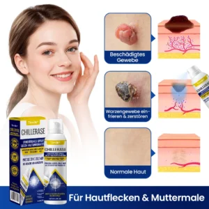 Spray gegen Hautunreinheiten - Image 2