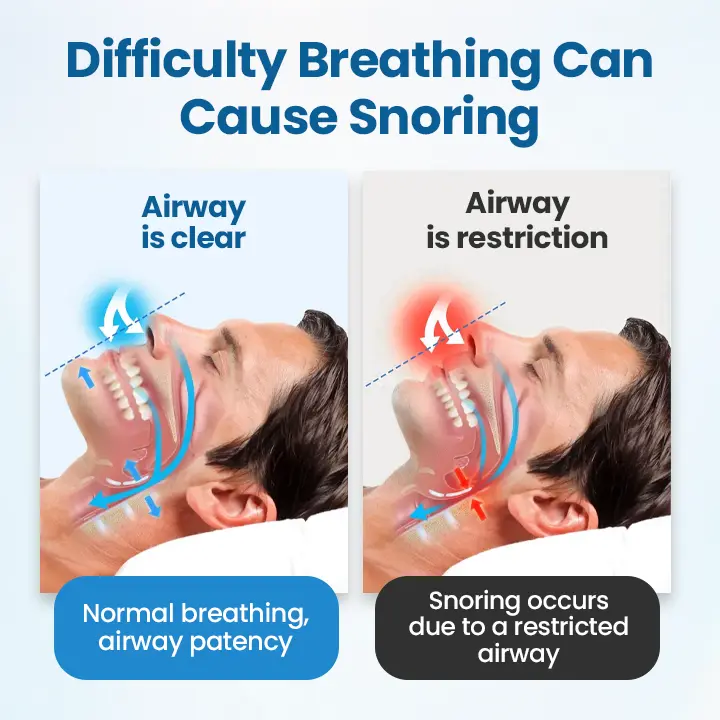 Nasal Breather - Image 4