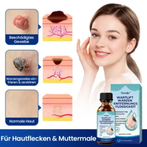 Warzen-Entfernungsflüssigkeit - Image 6