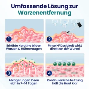 Warzen-Entfernungsflüssigkeit - Image 8