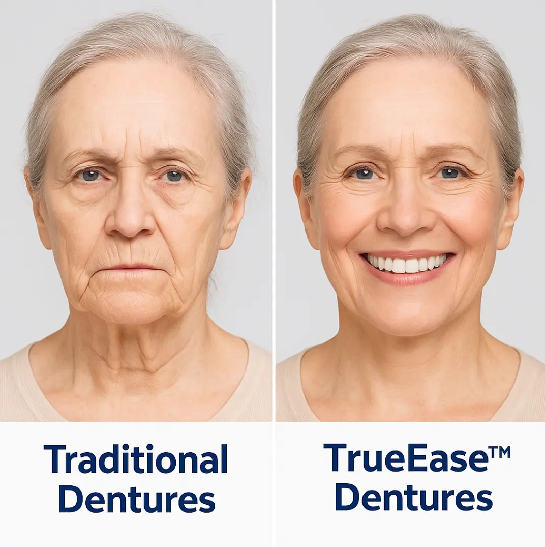 Custom-Fit Functional Dentures — Perfectly Fitted in Minutes at Home - Image 8