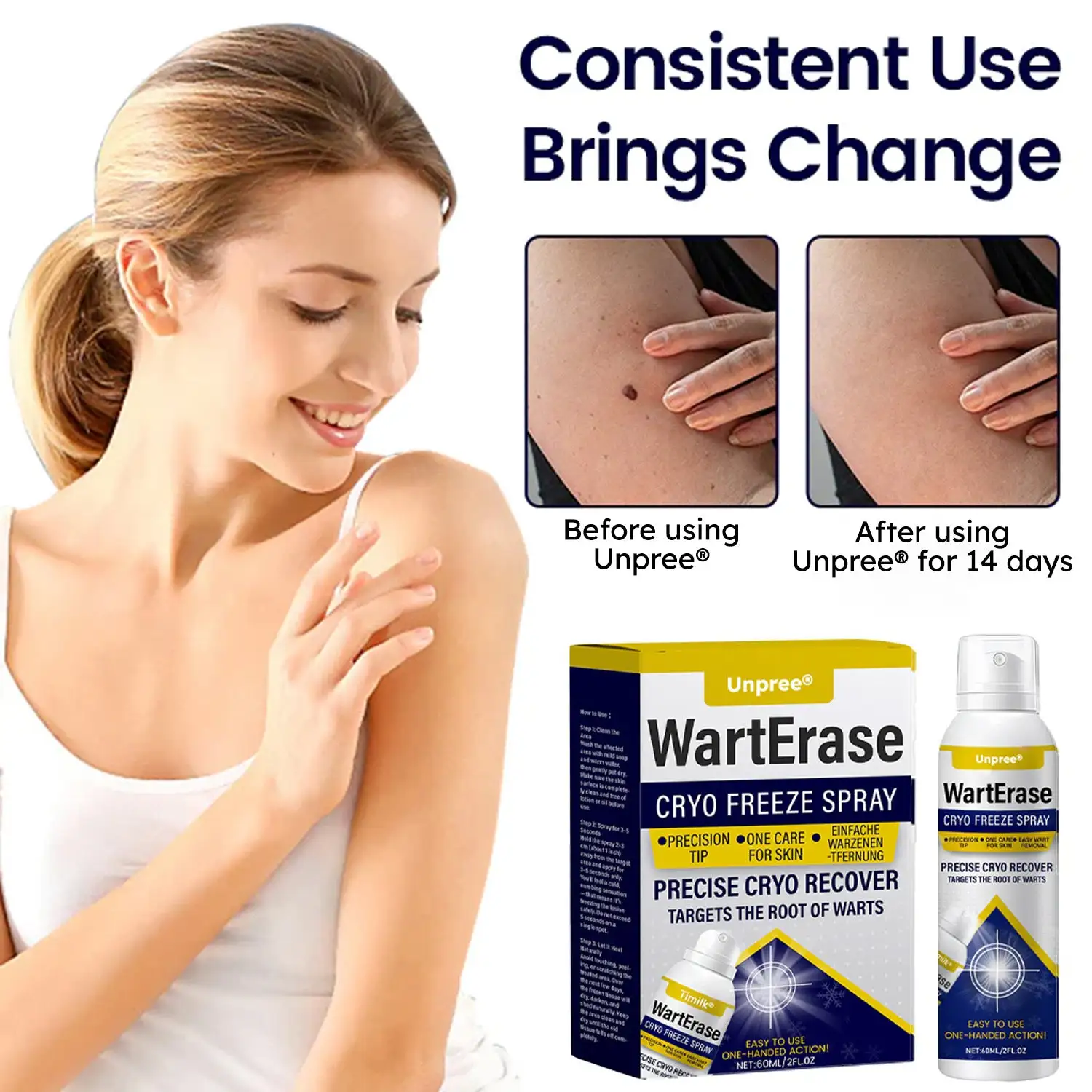 Cryo Freeze Spray