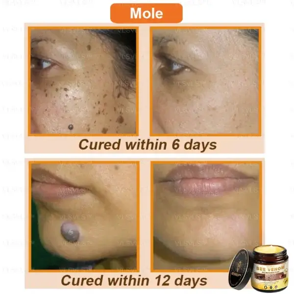 Bee Venom Skin Restoration Cream - Image 5