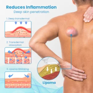 HEALumps Lipoma Treatment Ointment - Image 6