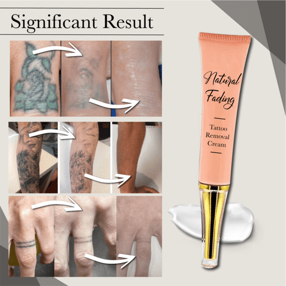 Natural Fading Tattoo Removal Cream - Image 5