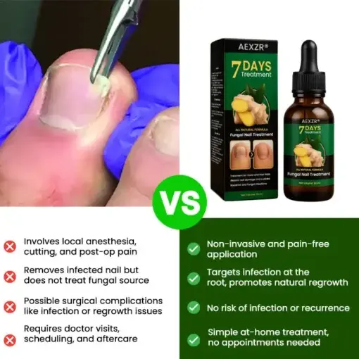 Fungal Nail Treatment - Image 4