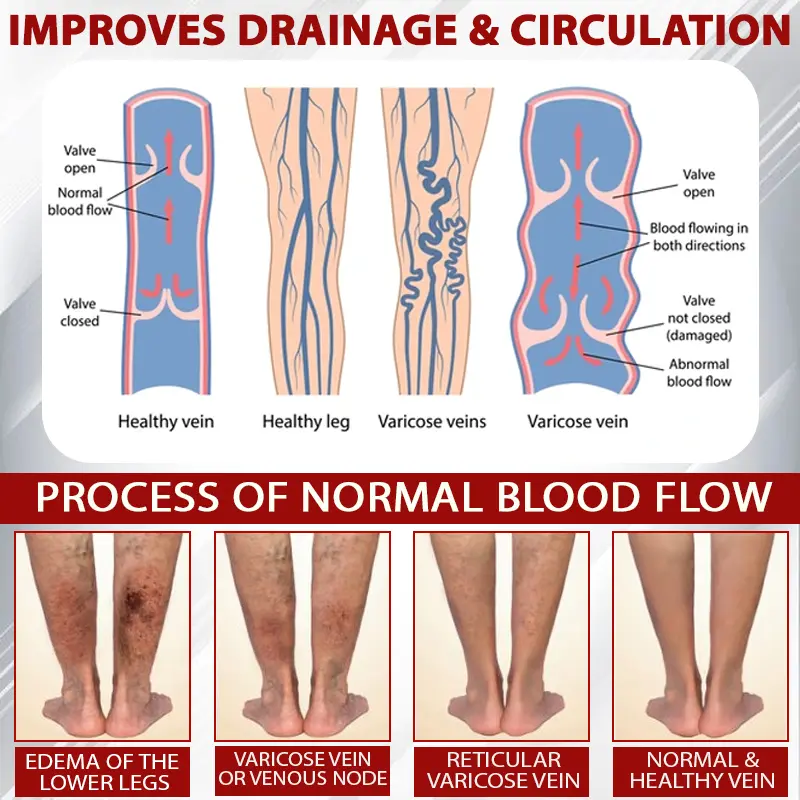 Advanced CVI Edema Therapy Cream - Image 8